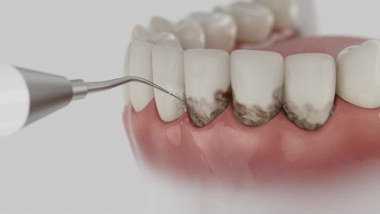 Trusted Root Canal Treatment service in Decatur, GA - Dentist Open Now